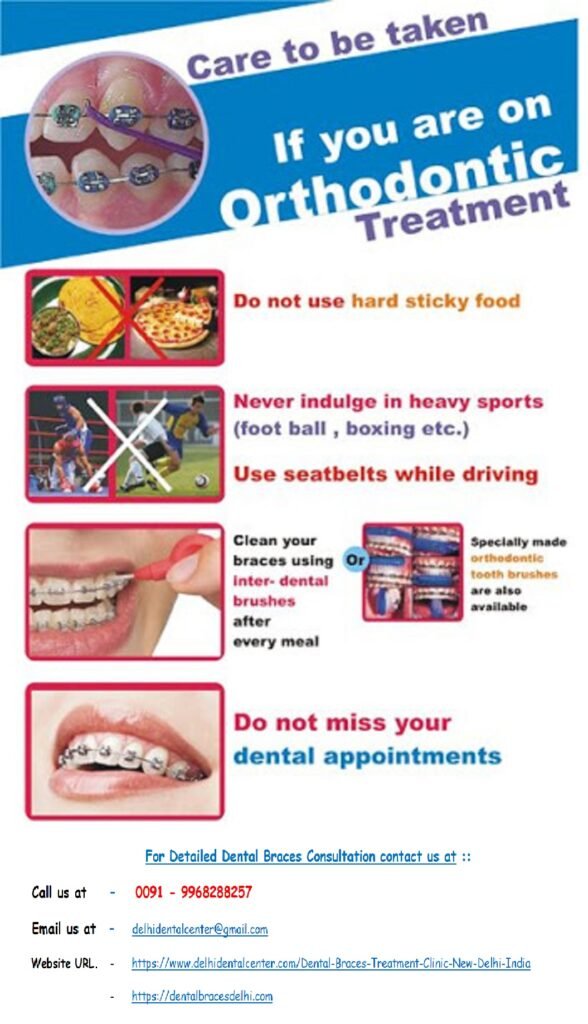 Dental Braces Specialist Dentist Orthodontist at Dental Braces Orthodontic Clinic in Krishna Nagar, East Delhi.