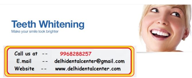 Tooth Whitening Treatment in Laxmi Nagar