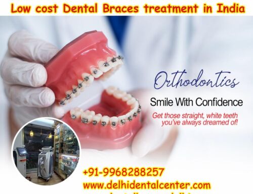 Zirconia Metal free Porcelain Ceramic Dental Crown Treatment in East Delhi.