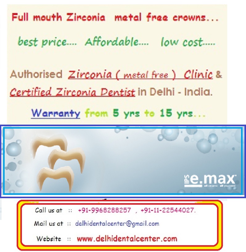 Zirconia, CAD CAM, Metal Free, All Porcelain, Full Ceramic Dental Crown, Tooth Cap treatment in Delhi.