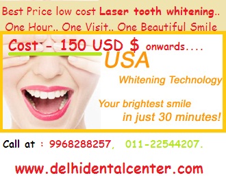 Tooth whitening Dentist in Delhi.