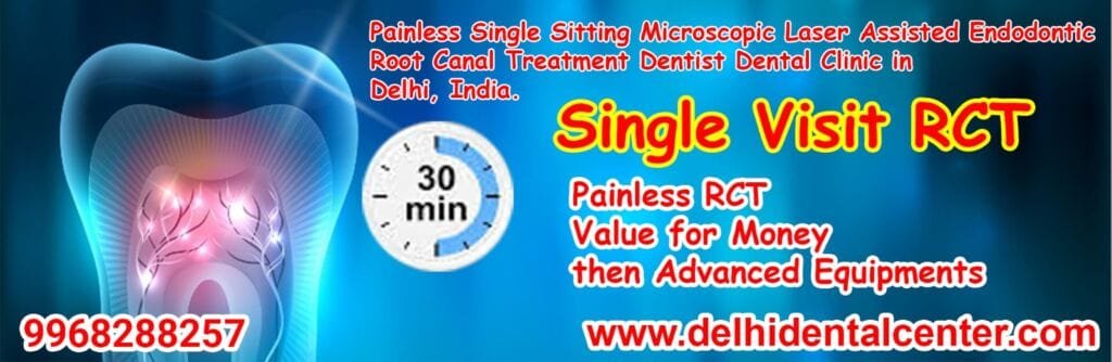 Root Canal Treatment Cost In India