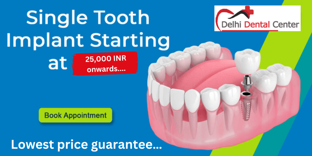 Single Tooth Dental Implant Cost in Delhi India