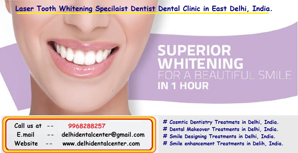 Teeth Whitening Delhi