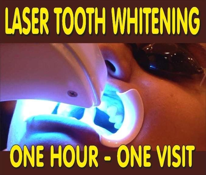 Cost of Teeth whitening in East Delhi India