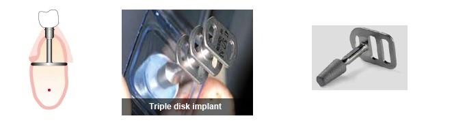 Triple Disk Implant