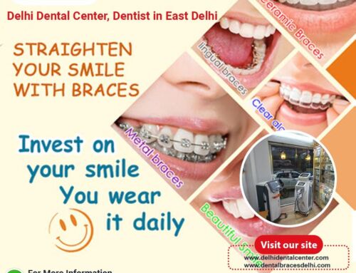 Delhi Dental Center, Top dental clinic in East Delhi