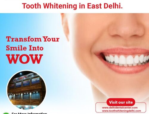 Best top dental braces aligners orthodontic treatment dental clinic in Delhi