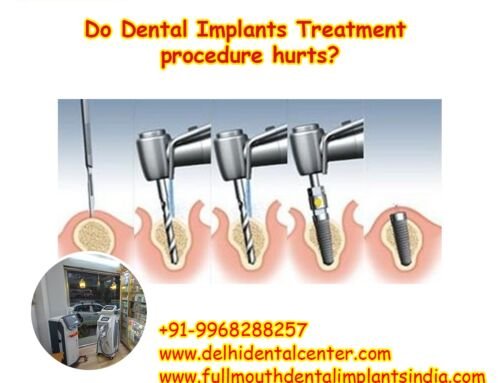 Do Dental Implants Treatment procedure hurts?