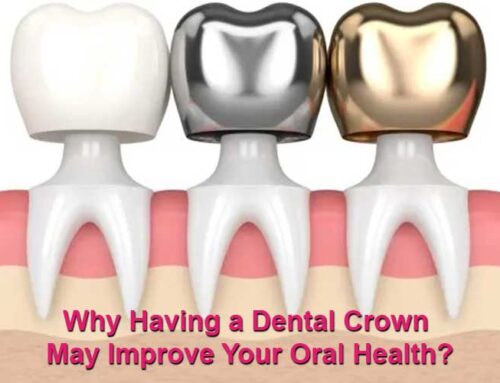 Why Having a Dental Crown May Improve Your Oral Health?