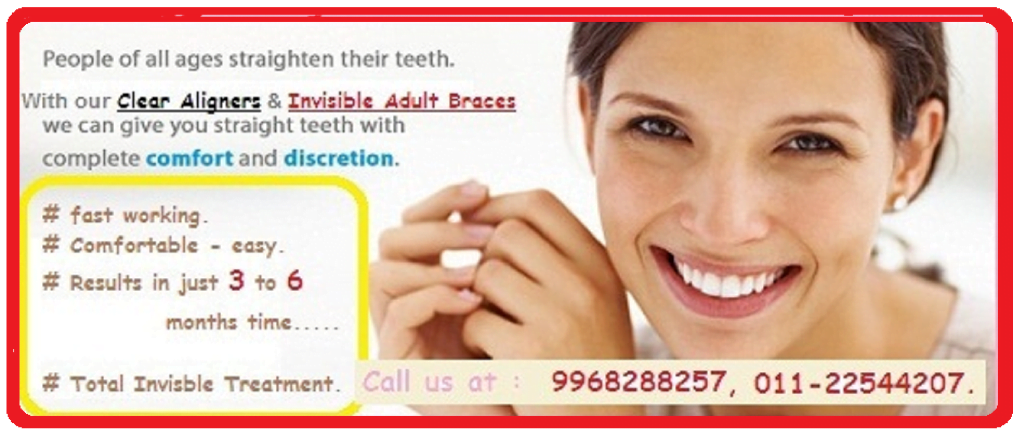 Adult Braces Treatment Delhi