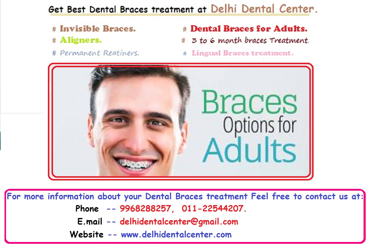 Invisible Dental Braces in East Delhi