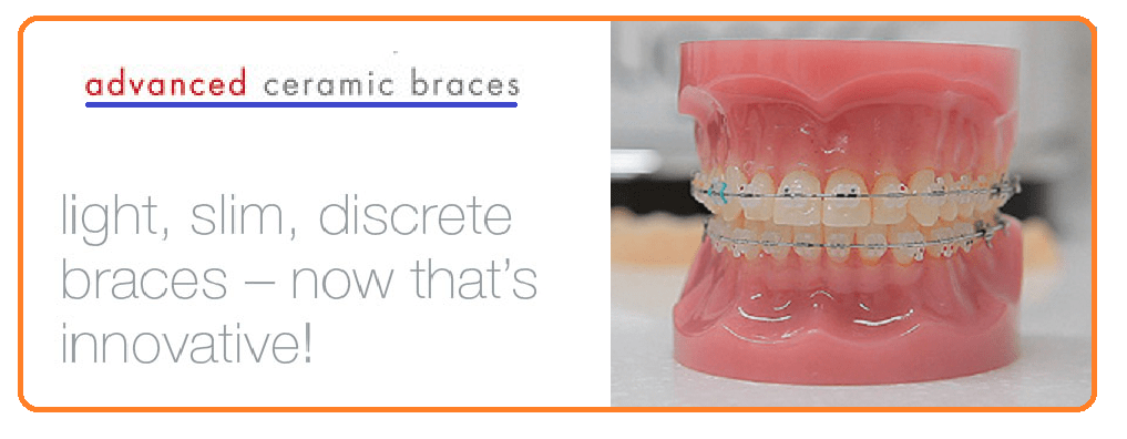 advance ceramic braces