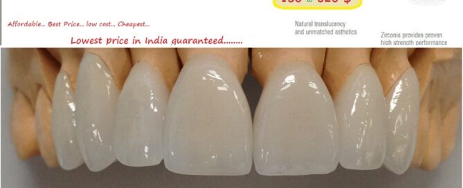 Teeth in an Hour Same Day Immediate Porcelain Zirconia Ceramic Dental Crown Tooth Cap Treatment at Dental Crown Clinic in India