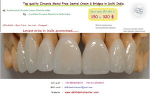 Teeth in an Hour, Same Day Immediate Porcelain Zirconia Ceramic Dental Crown Tooth Cap Treatment at Dental Crown Clinic in Delhi.