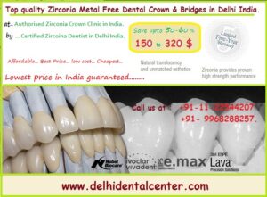 Same Day Zirconia Dental Crown Clinic in Delhi.