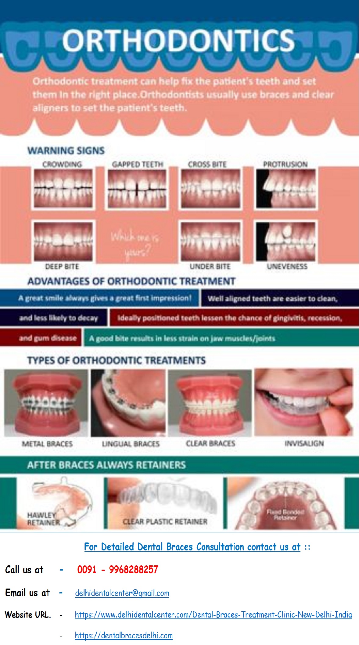 Dental Braces Orthodontic Treatment Dental Clinic in Pandav Nagar run by Dental Braces Specialist Dentist Orthodontist in Pandav Nagar, East Delhi – India.