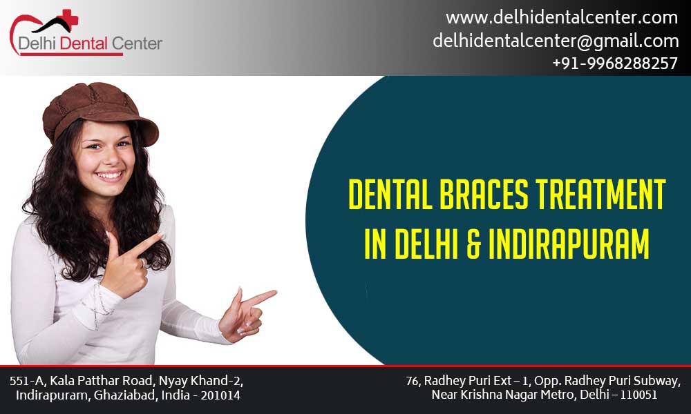 Dental Braces Dentist in Laxmi Nagar