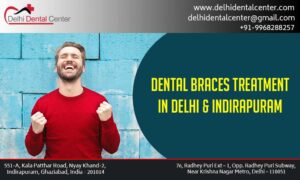 Dental Braces in Laxmi Nagar