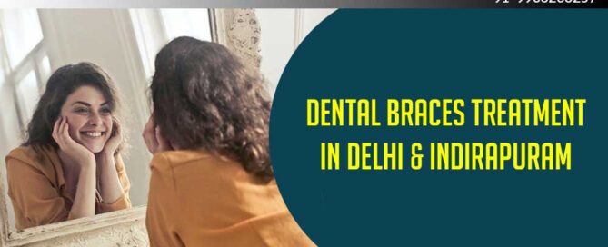 Dental Braces Treatment in East Delhi