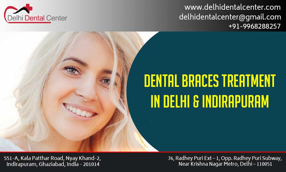 Dental Braces Clinic in East Delhi