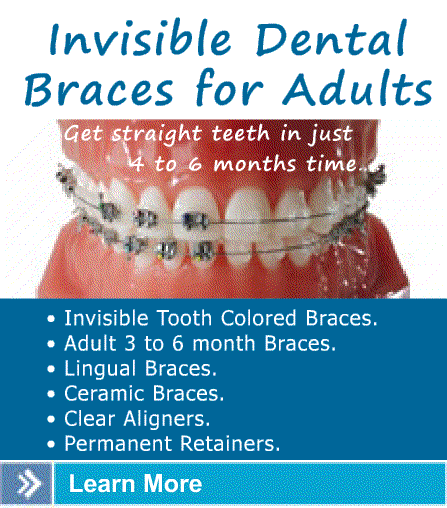 Dental Teeth Braces Specialist Dentist Orthodontist in Arjun Nagar East Delhi