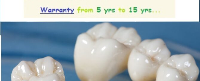 Porcelain Zirconia Ceramic CAD CAM Metal Free Dental Tooth Crowns, Dental Tooth Cap Treatment at Dental Crown Dentist Dental Clinic near Vasundhara in East Delhi
