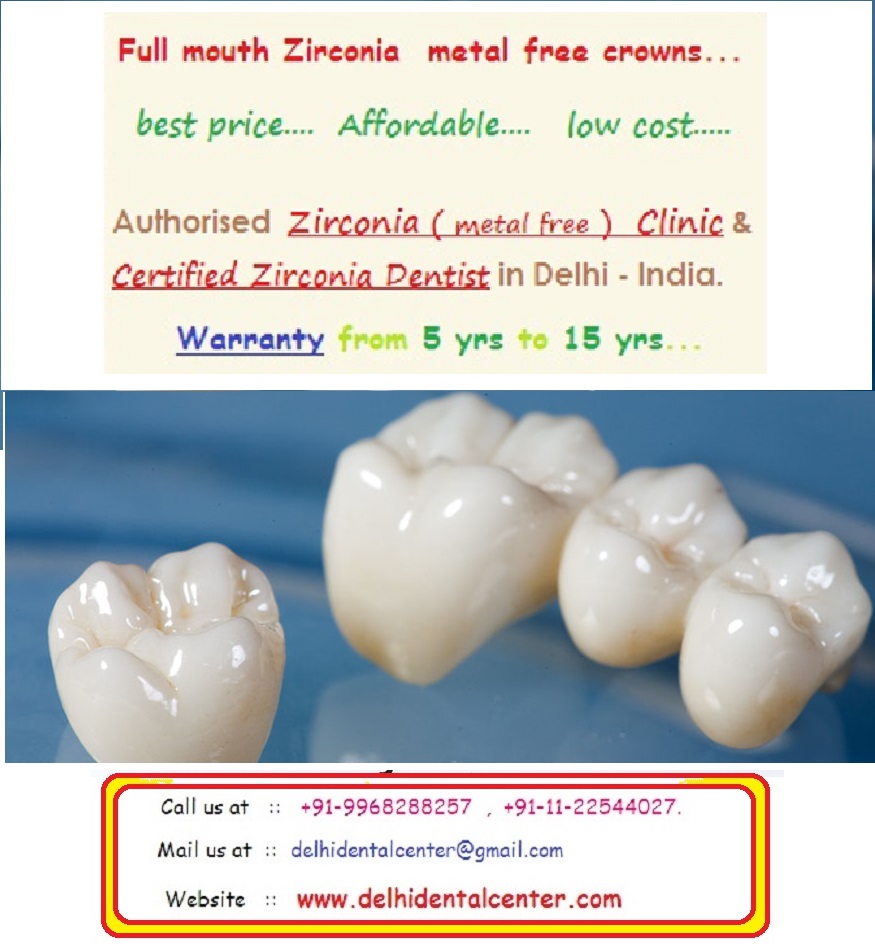 Zirconia Dental Crown Treatment in Delhi.
