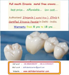 Zirconia Porcelain Ceramic Dental Crown Tooth Cap Treatment Procedure Dentist Dental Clinic in Delhi.