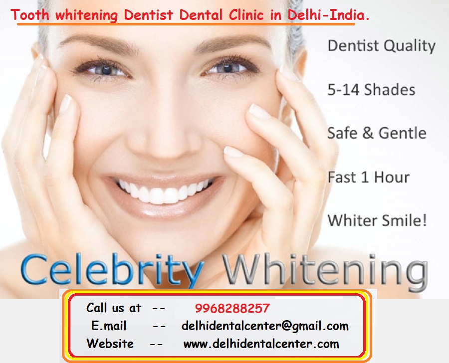 Laser Tooth Whitening Dental home teeth Bleaching Treatment at Tooth Whitening Dentist Dental Clinic in East Delhi.