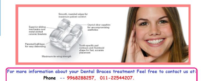 Dental Aligners Treatment in East Delhi