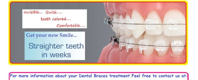 Tooth Coloured Invisible Dental Teeth Braces Treatment in East Delhi