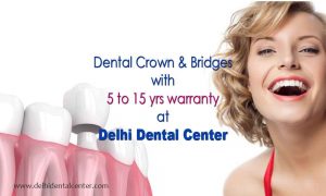 Dental crown Delhi