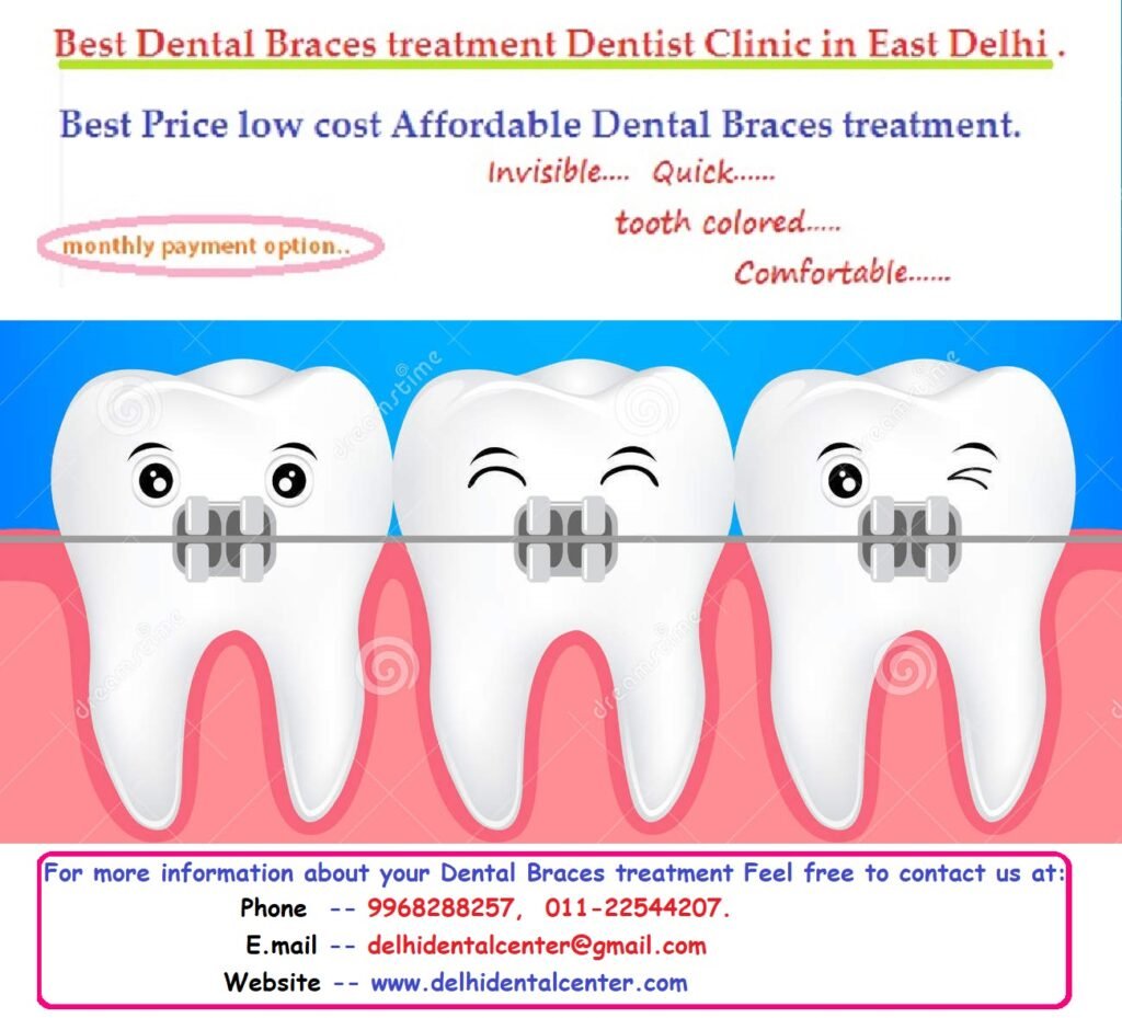 Dental Braces Orthodontic Clinic in East Delhi