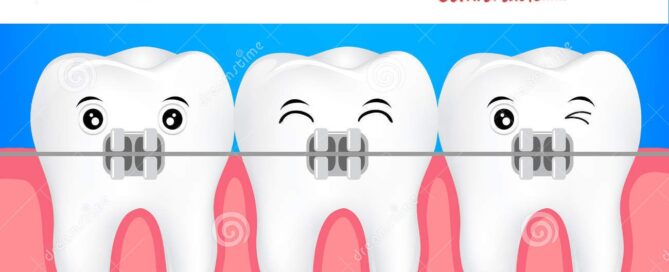 Dental Braces Orthodontic Clinic in East Delhi
