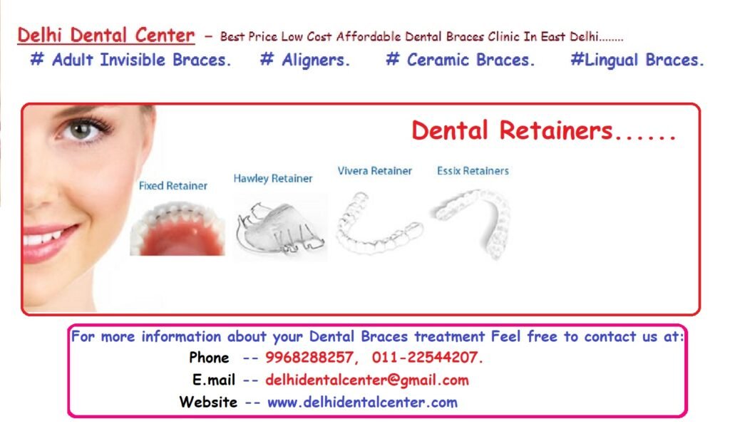 Dental Aligners Treatment in Pandav Nagar, East Delhi.