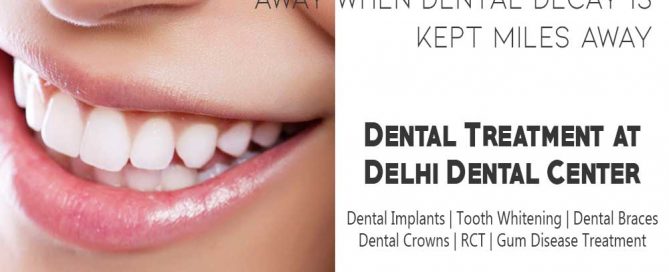 Tooth Whitening in Jagriti Enclave