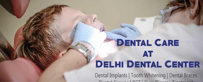 Tooth Whitening Delhi