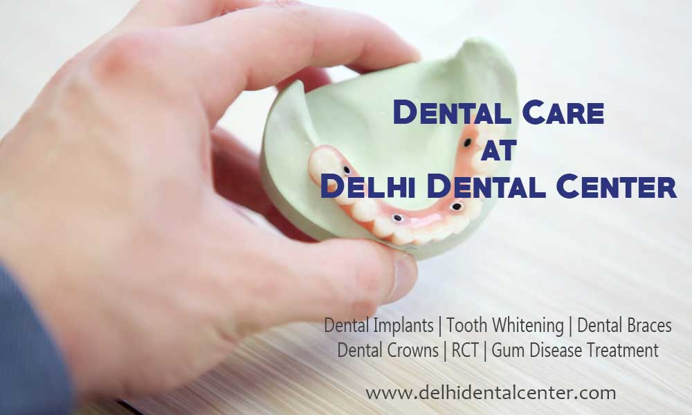 Tooth White in Delhi