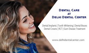 Dental Implant Delhi