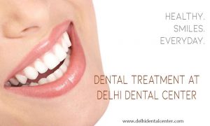 Tooth Whitening in Delhi