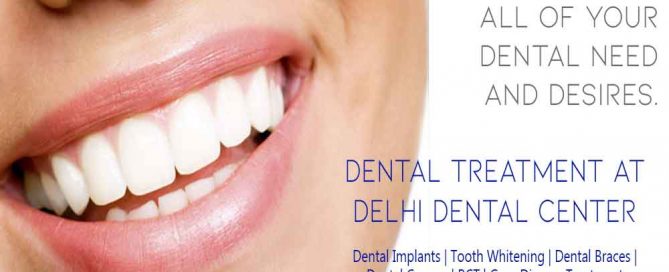Immediate Loading Dental Implants