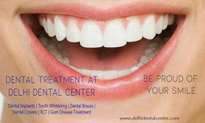 immediate dental implant treatment