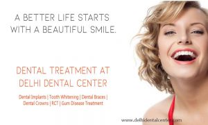 Tooth Whitening in Anand Vihar