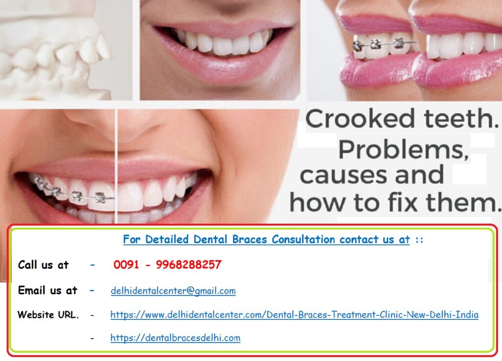 Dental Braces, Aligners, Retainers