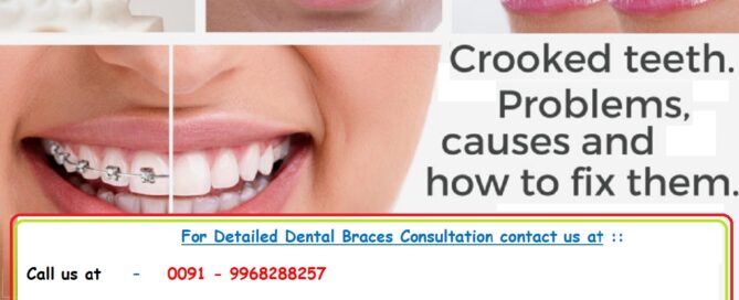 Top Best Adult Invisible Tooth Colored Ceramic Orthodontic Dental Braces Aligners, Retainers, Expansion Plates, Treatment in East Delhi.