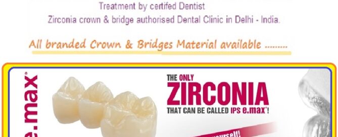 Zirconia, Porcelain, Ceramic Dental Crown Tooth Cap Treatment Procedure Dentist Dental Clinic in India.