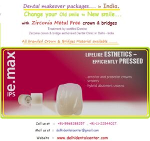 Zirconia Dental Crown procedure in Delhi.