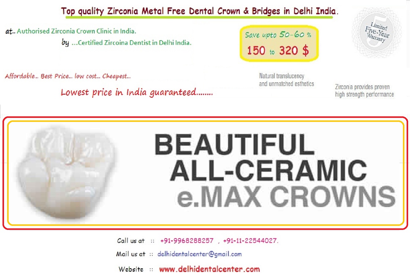 Same Day Zirconia Dental Crown treatment in Delhi.