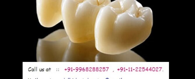 Best Top Teeth in an Hour, Same Day Immediate Porcelain Zirconia Ceramic Dental Crowns, Dental Cap Treatment at Dental Crown Dentist Dental Clinic in Indirapuram, Noida, Ghaziabad.